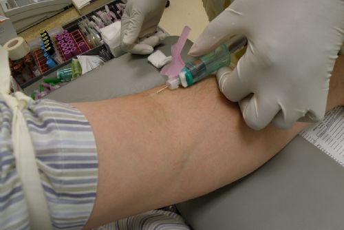 Movember odhalilo 17 podezření na korcinom