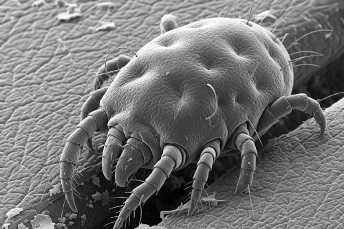 Na sušické základce se objevil svrab, Plzeňský kraj má dlouhodobě vysoký výskyt